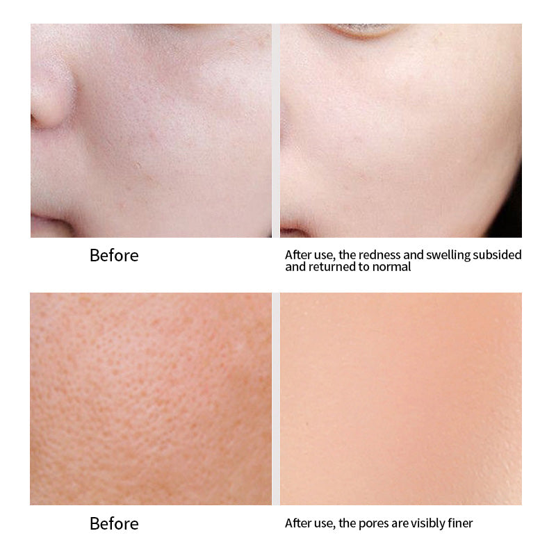 PERFECT CARE Pore Minimizing Serum, Facial Essence for Shrinking Pores